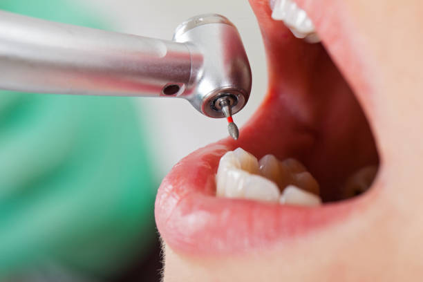 Best Emergency Dental Care for Sports Injuries in Aledo, IL
